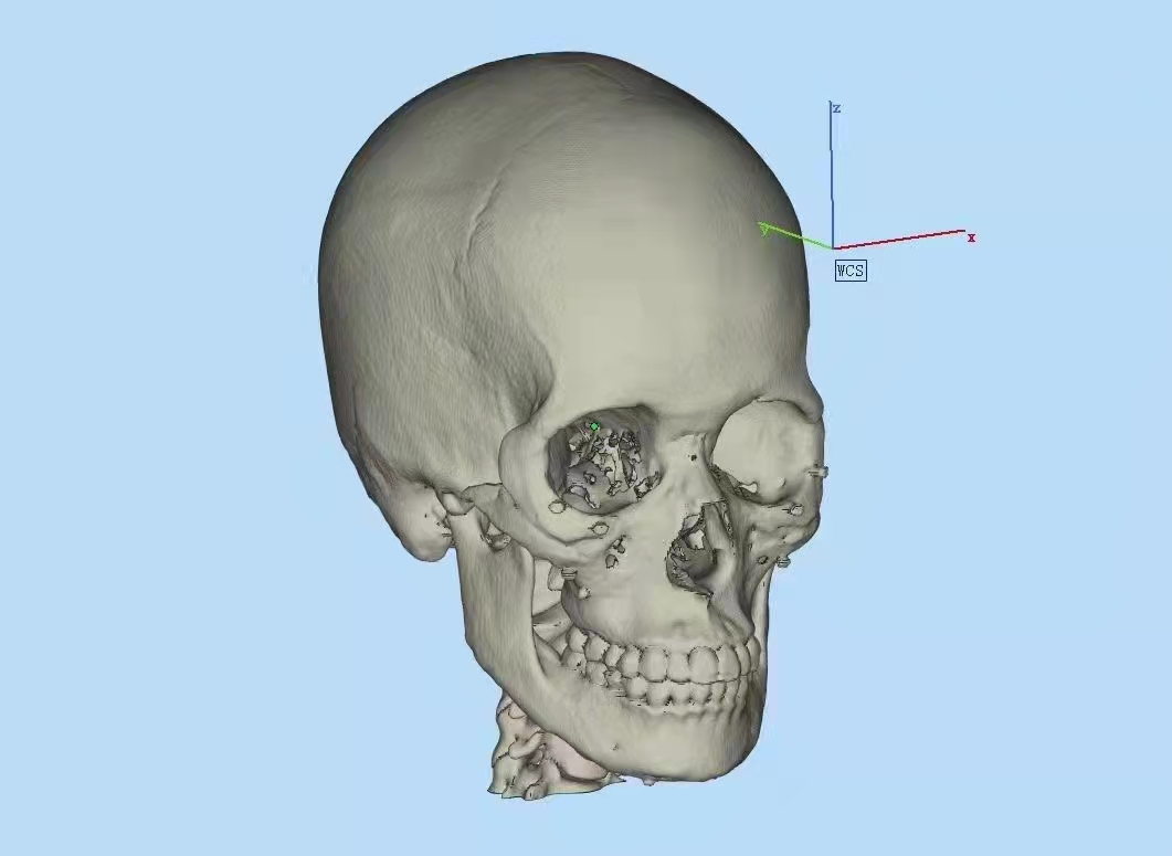 3D打印 3D打印