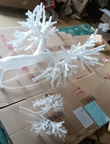 3D打印透明氣管支架 3D打印透明氣管支架